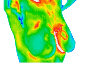 ICAM Thermography
